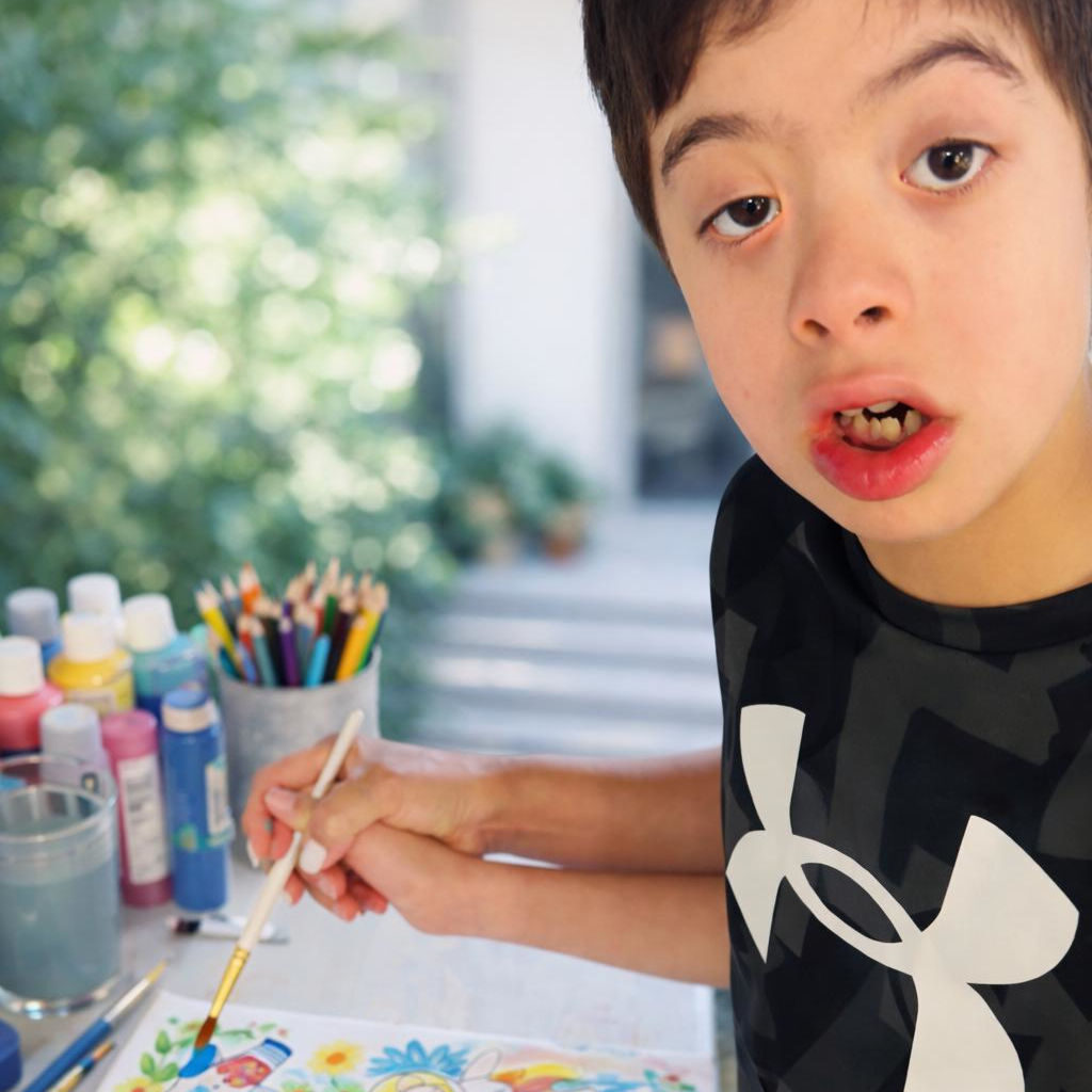 Impact down sindrome boy